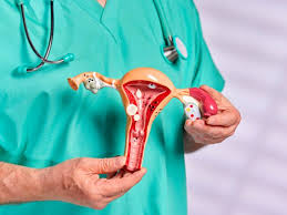Ovarian Cancer Surgeon